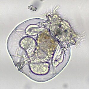 Rotifer under the microscope